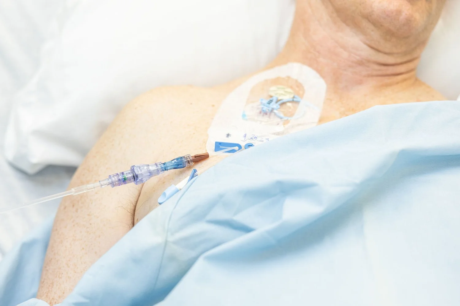 Lineus Medical