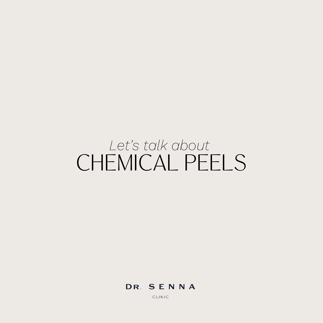 Chemical peels are so underrated! They are an amazing way to tackle a lot of skin concerns including; dull complexion, uneven skin tone, pigmentation, fine lines and wrinkles. 

There are various strengths of peels you can go for depending on your co