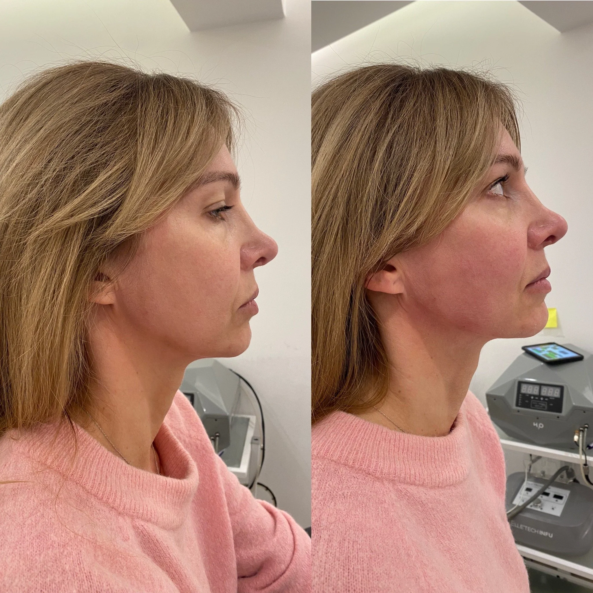 9E1FEC87-3B26-4B37-B952-C5416AC9918F 2.JPG