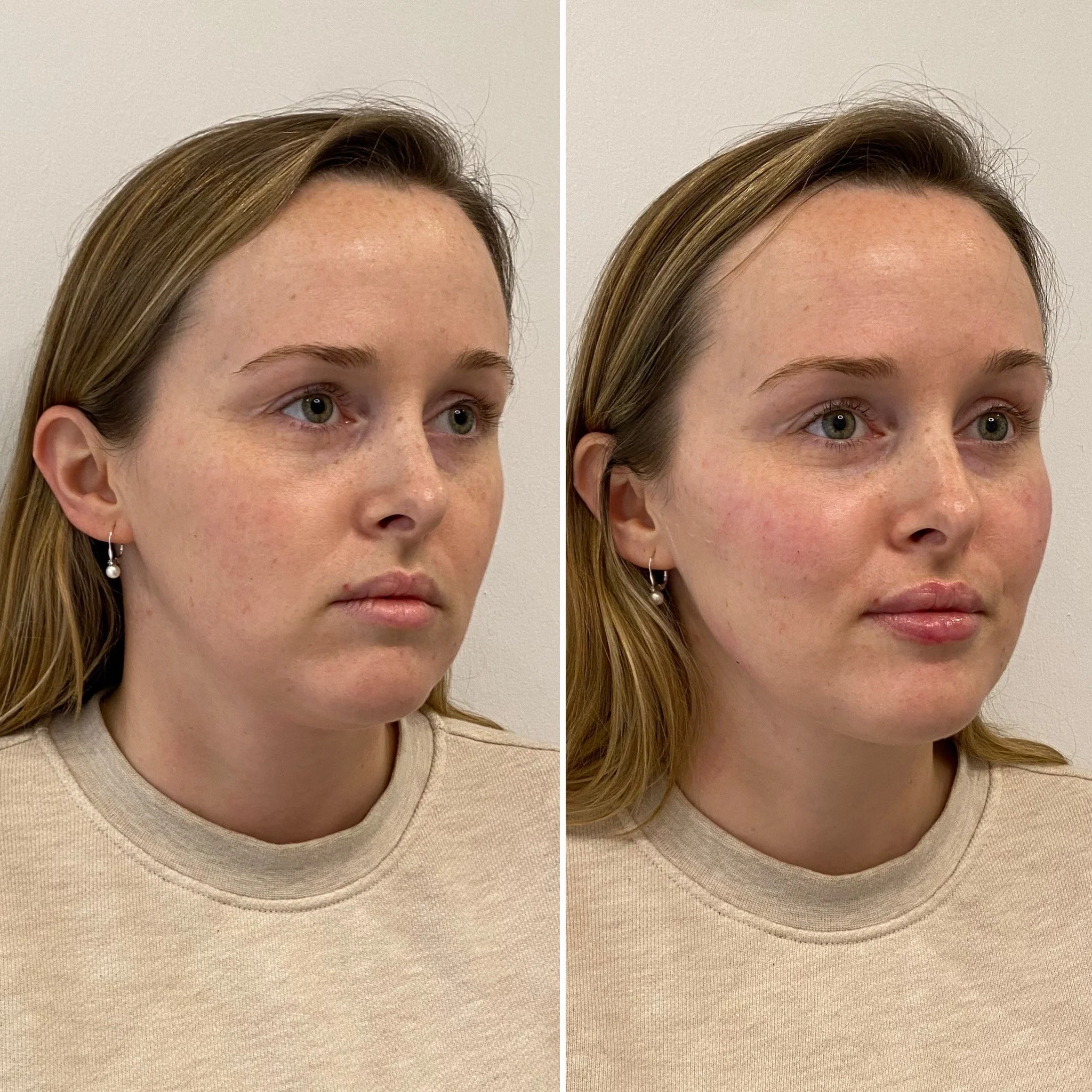 1119FC06-68ED-4310-B590-B2E6BF832AFD 2.JPG