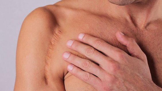 Scar Tissue Mobilization: Our Holistic Approach to Healing