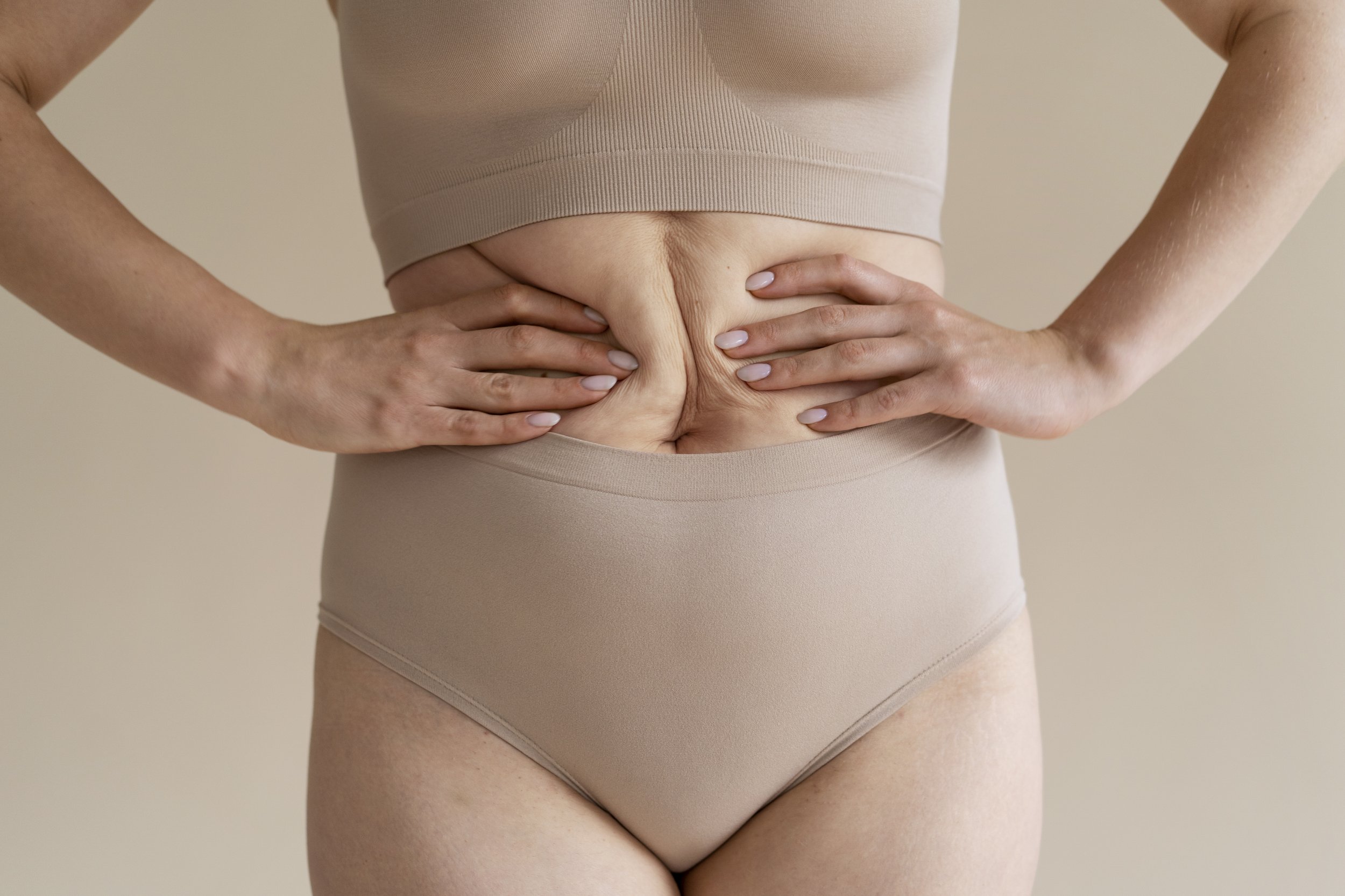 Diastasis Recti, a Bulge in Lower Ab