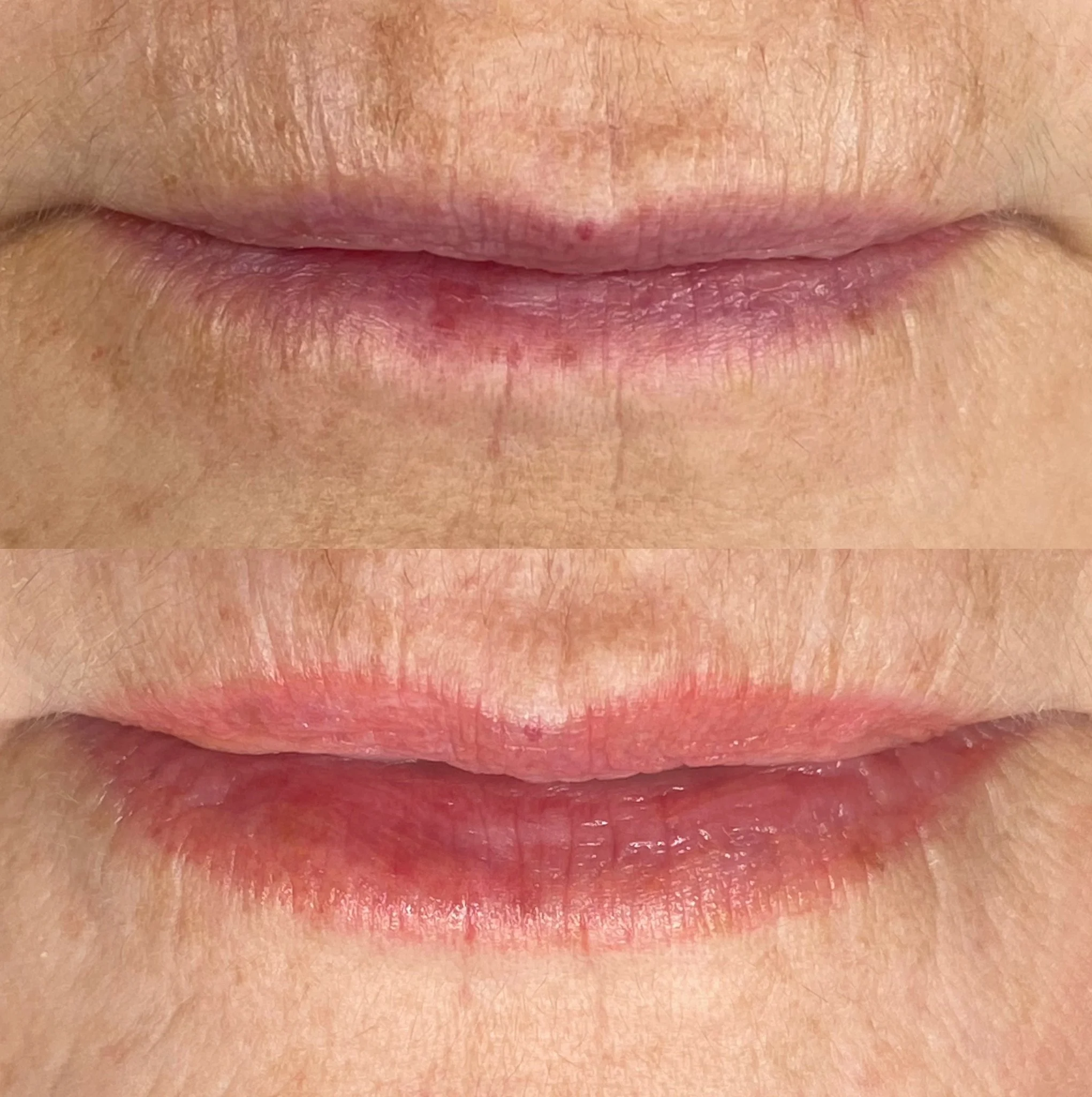 Close-up of a person's lips before and after moisturizing, showing smoother and more hydrated lips in the after image.