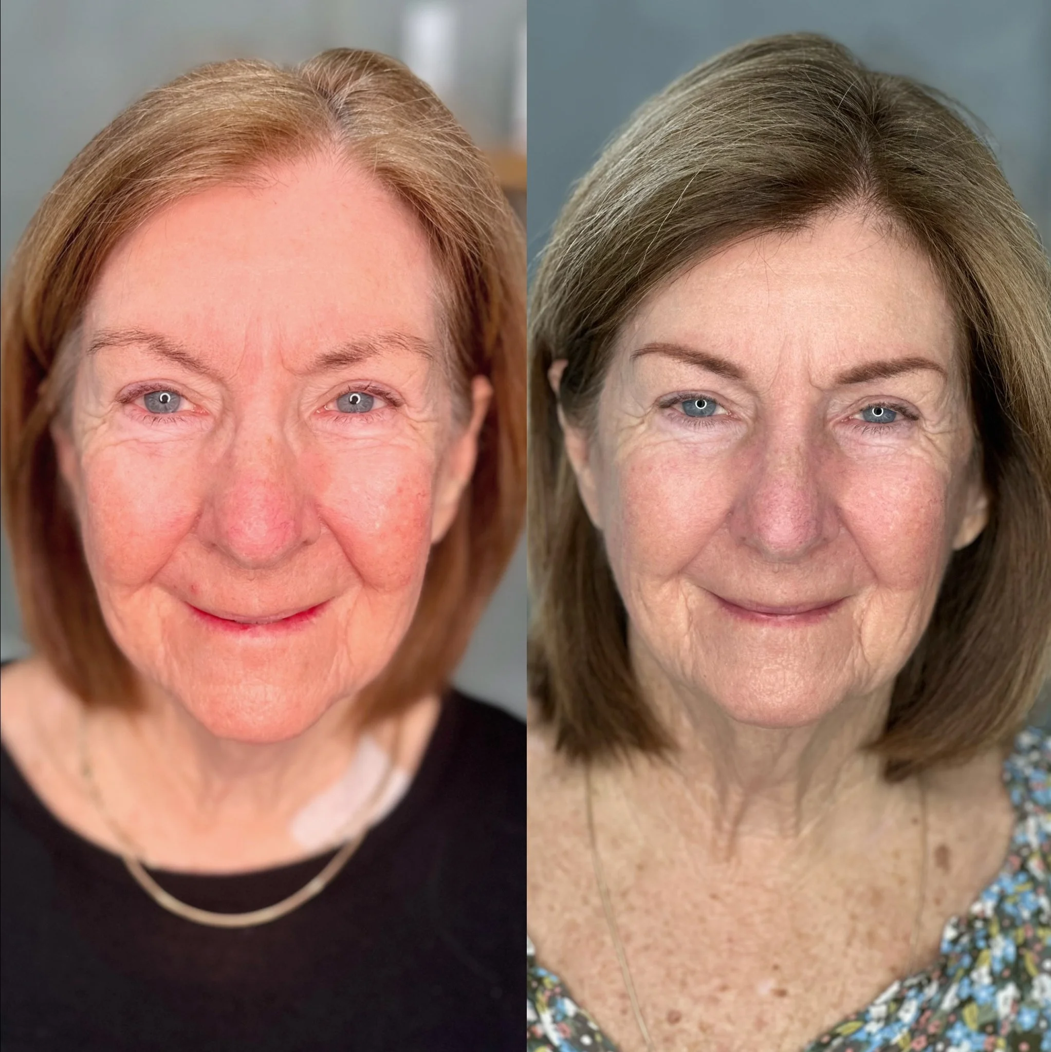 Comparison of two close-up portraits of an elderly woman with grey eyes and brown hair, showing her before and after cosmetic or skincare treatment, with visible improvements in skin texture and appearance.