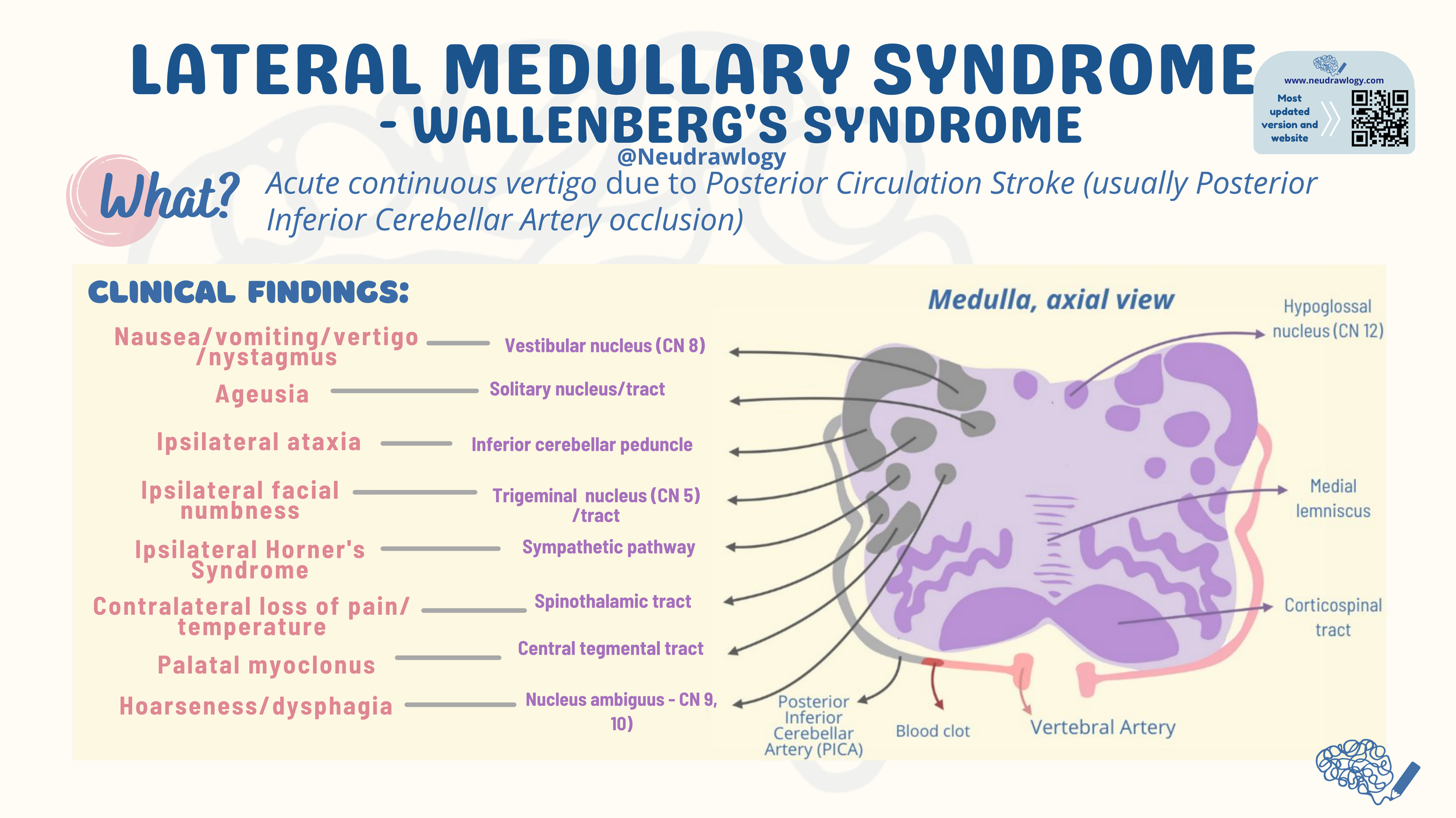 Wallenberg Syndrome Clinico Radiological Profile Of Patients With