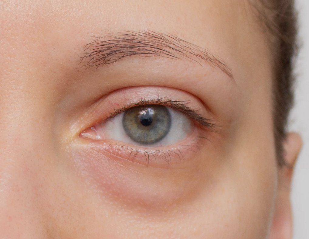 Why you feel puffy: sodium, carbs, stress, and sleep