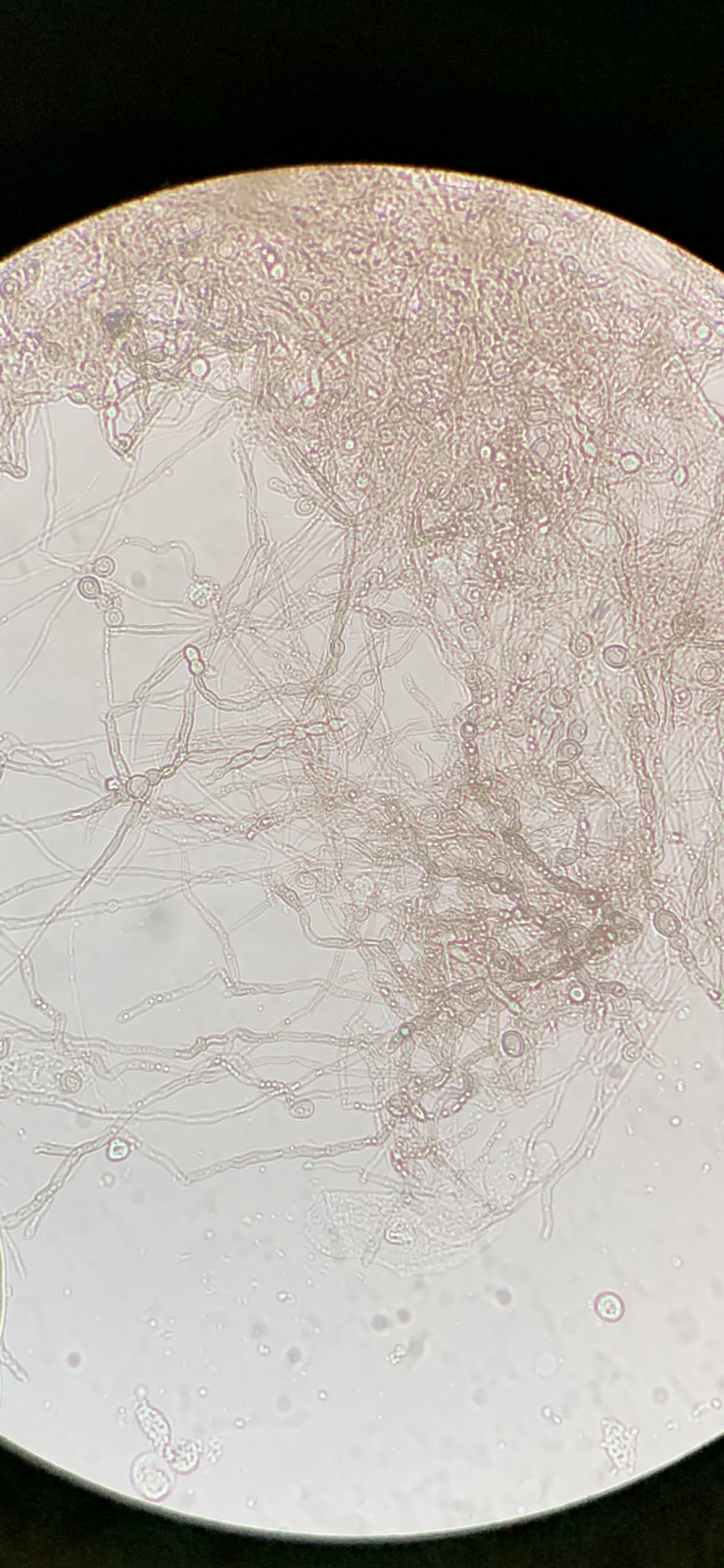 Yeast pseudohyphae and buds