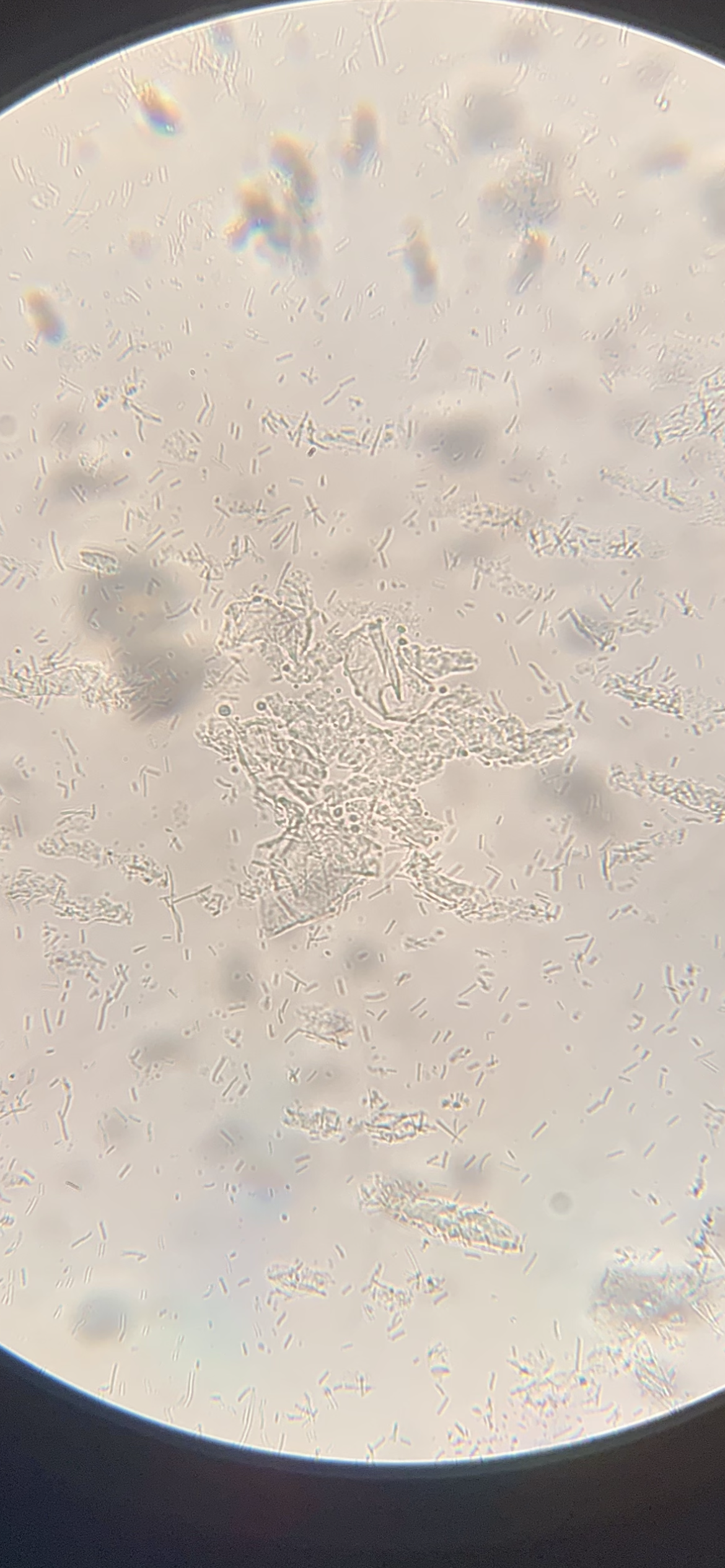 Abundant lactobacilli