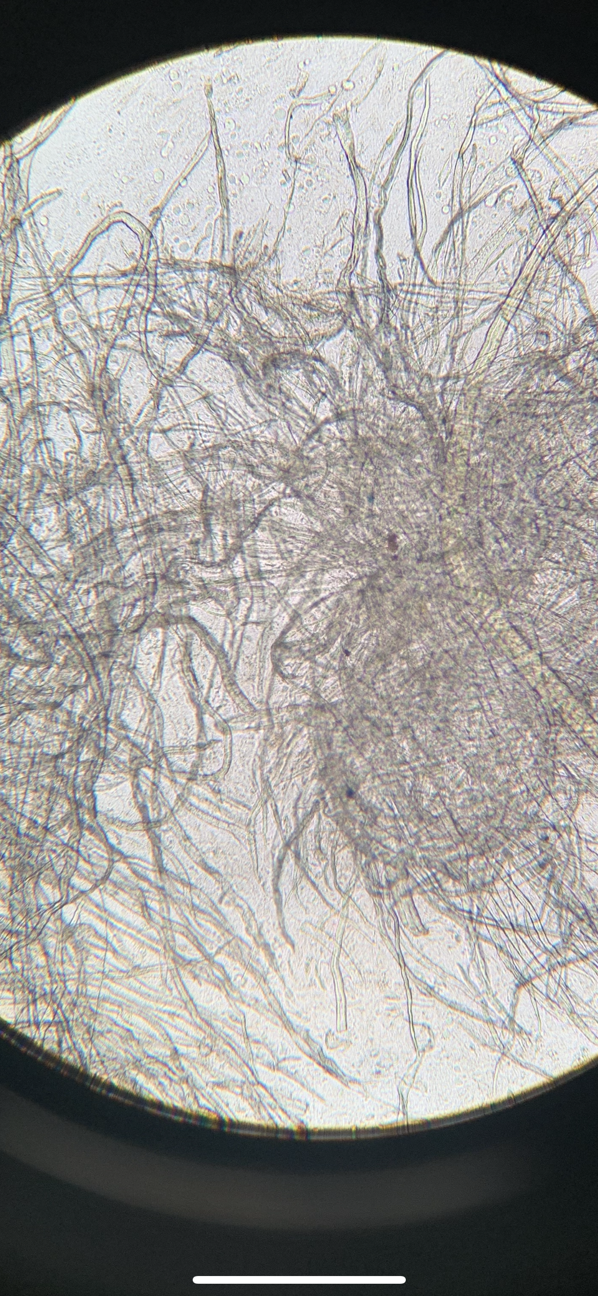 Artifact (tampon fibers)