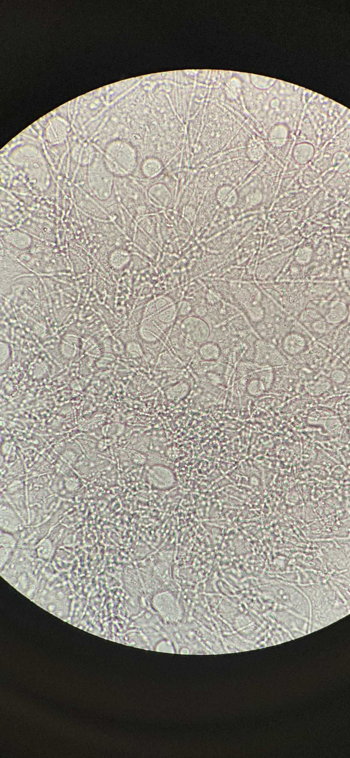 Yeast pseudohyphae