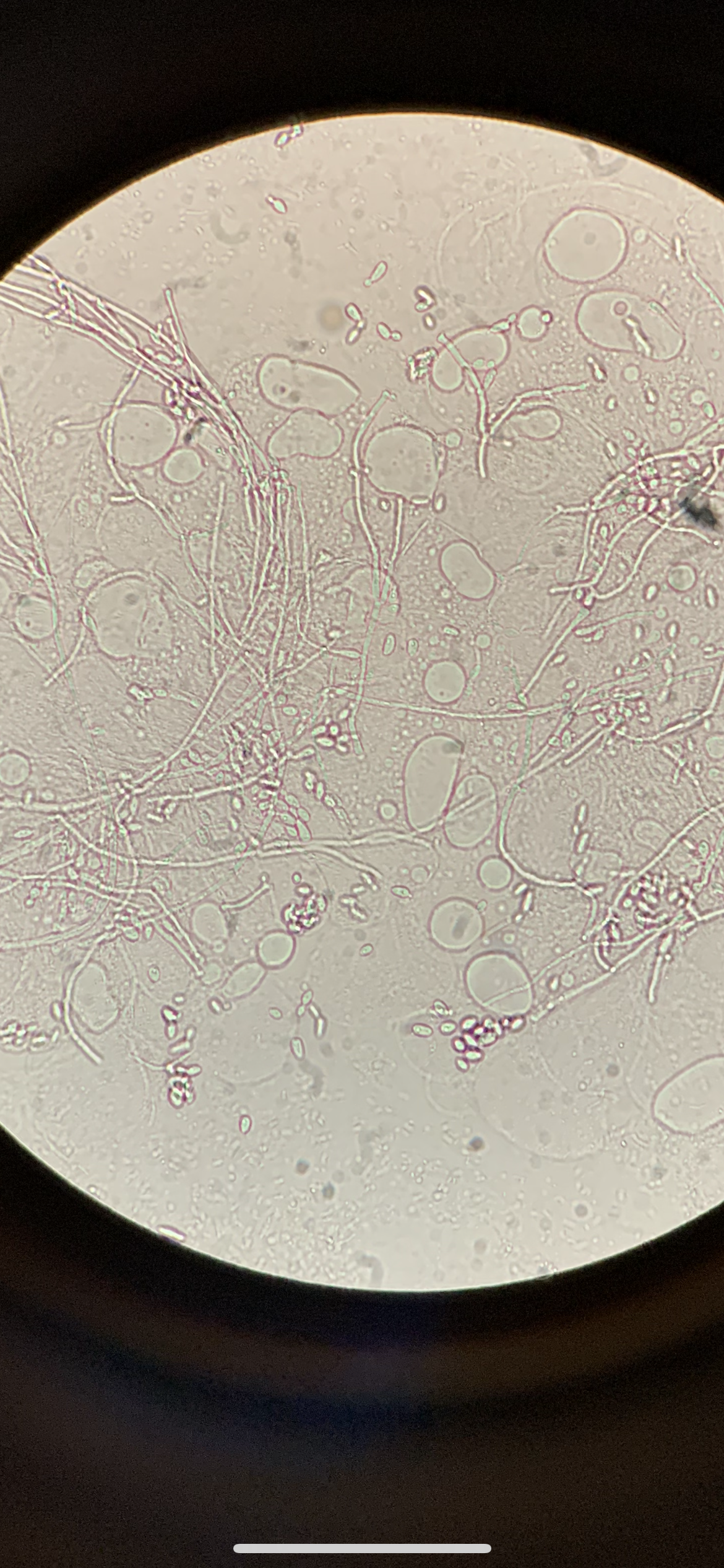 Yeast pseudohyphae and buds