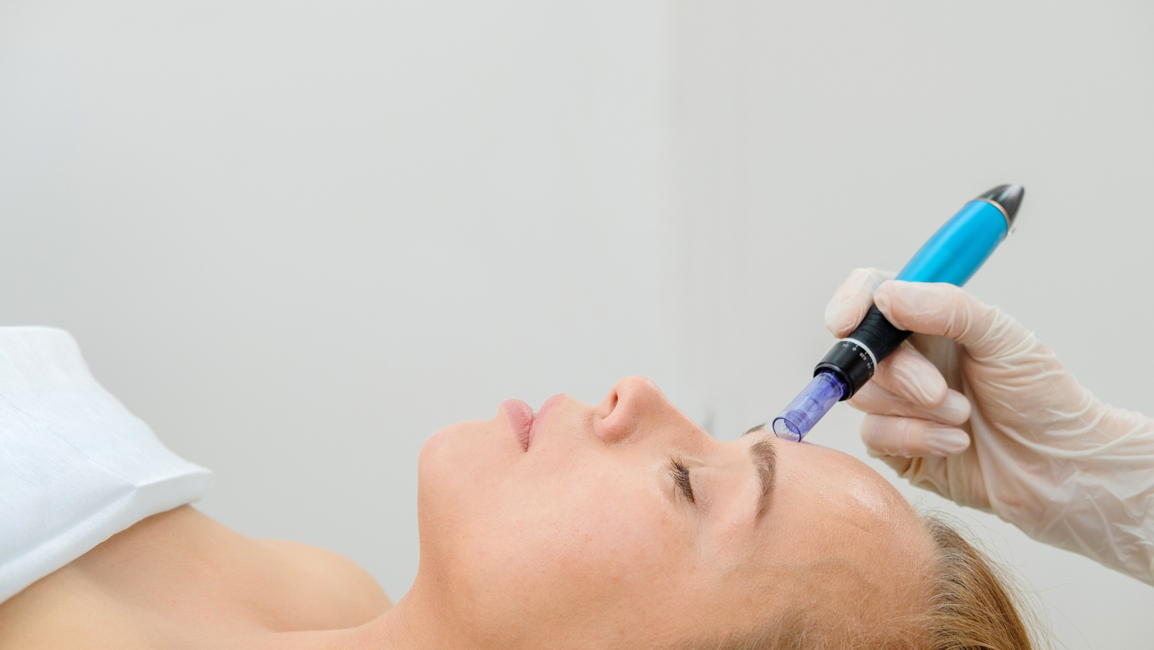 A medical professional wearing gloves uses a microneedling device on a woman's face during a cosmetic procedure, lying on a treatment bed with a white pillow.