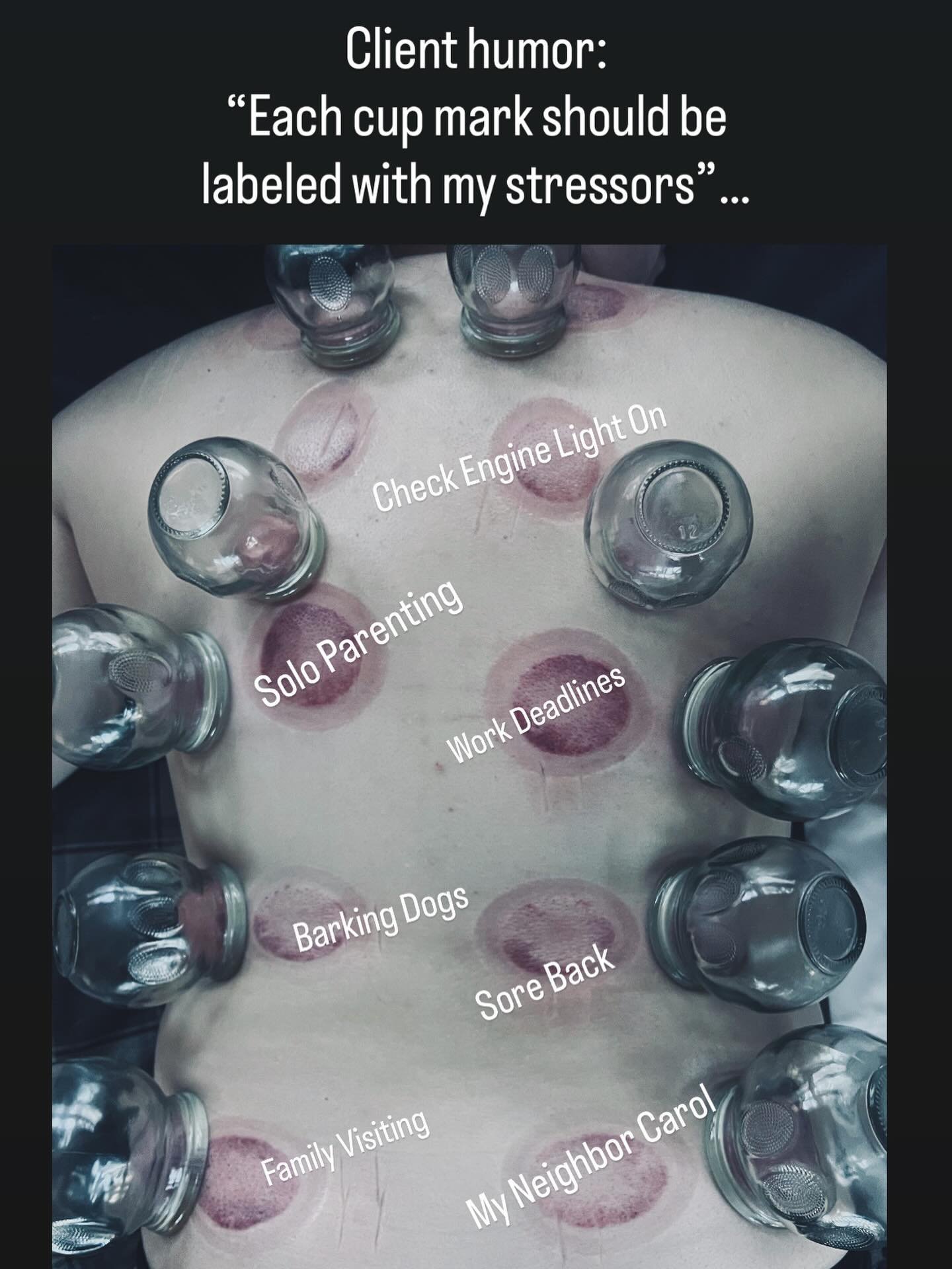 Feel relatable? Let me repeat this for those in back&mdash; the body keeps score! Watch out for March&rsquo;s monthly offer dropping this weekend&hellip; there might be some of this cupping relief involved 😉