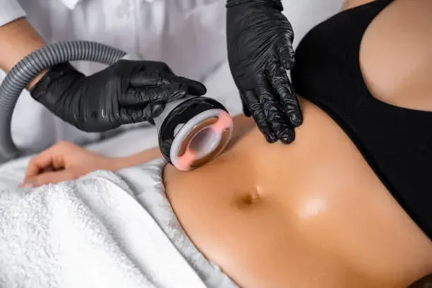 Is Body Sculpting Safe? What You Need to Know Before You Try It