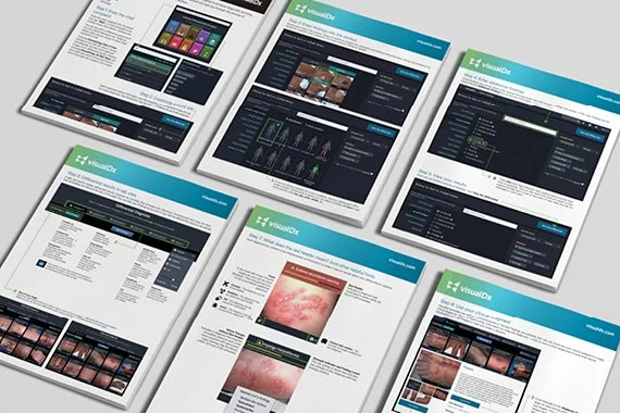 Build a Differential Walkthrough.jpg