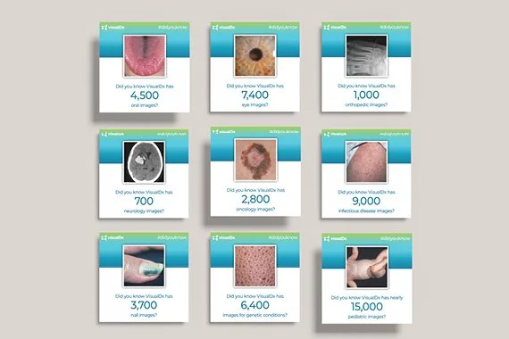 Did You Know - VisualDx Content.jpg