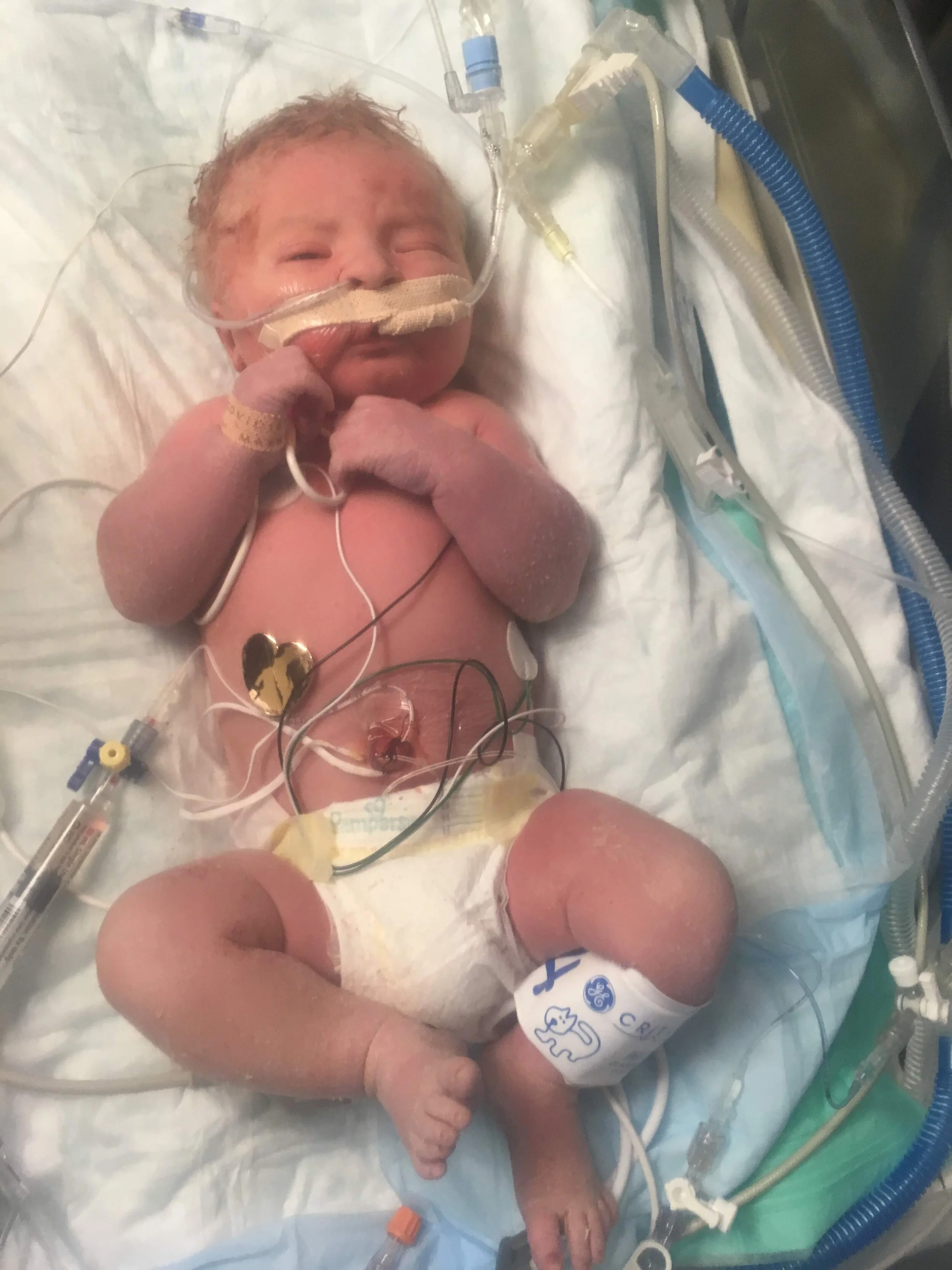 baby in NICU portrait