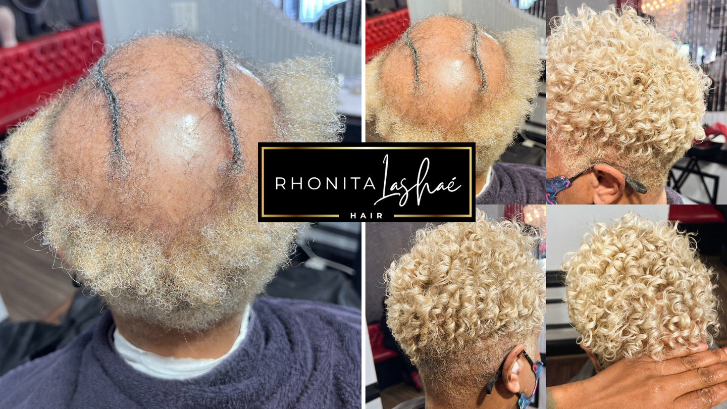 Wigs for Alopecia/Hair Loss