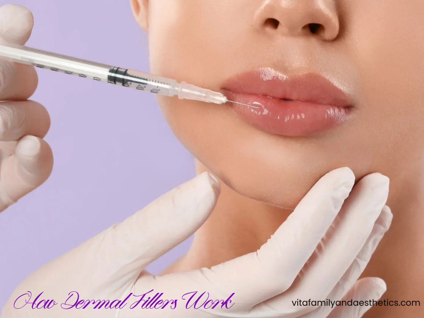 How Dermal Fillers Work: Healing Time, Results, and What to Expect in Fayetteville, NC
