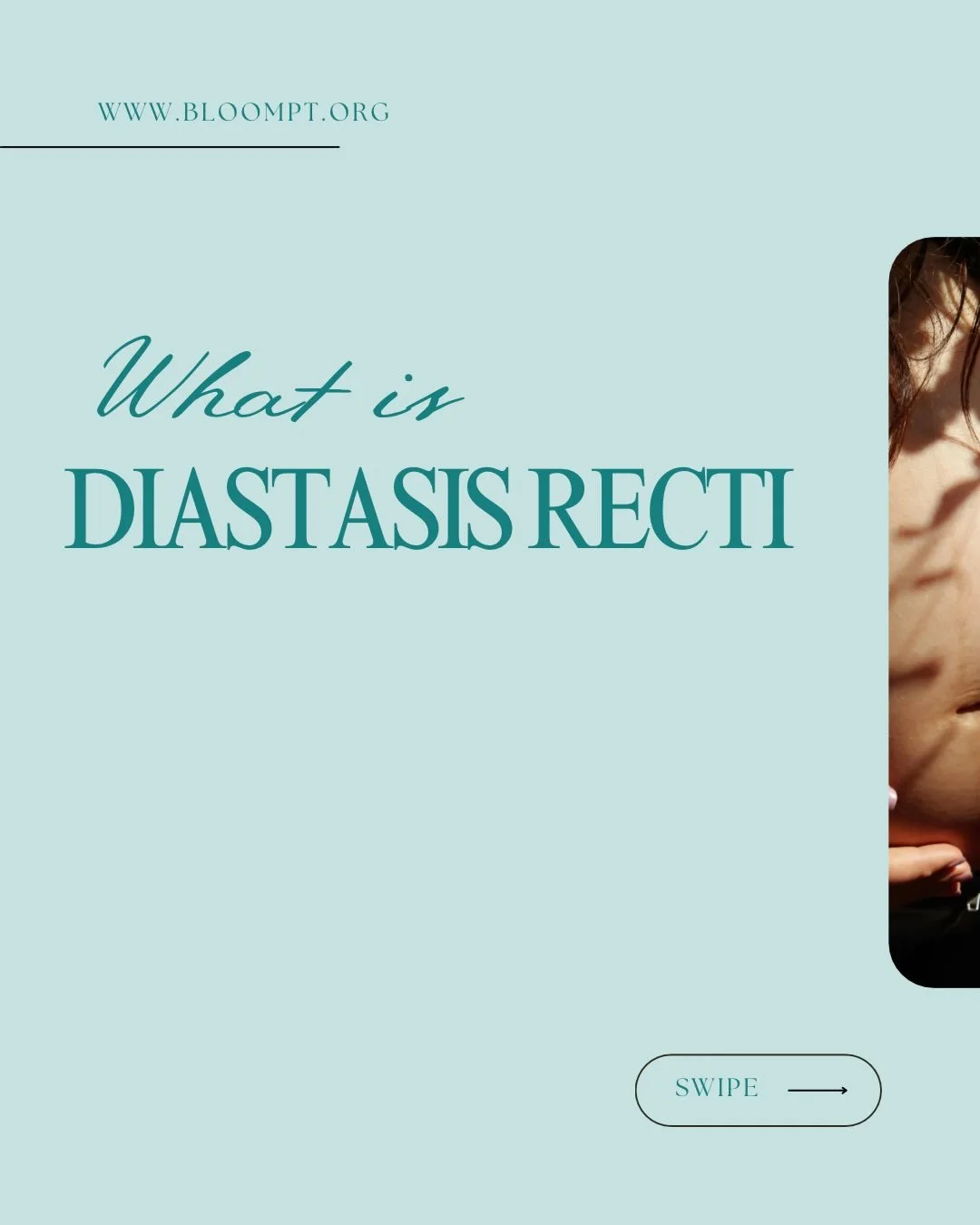 Diastasis Recti is more common than you think&mdash;and it&rsquo;s absolutely treatable with the right care!

If you notice a &ldquo;doming&rdquo; or bulge down the middle of your belly, a lingering postpartum pooch, low back pain, or core weakness a