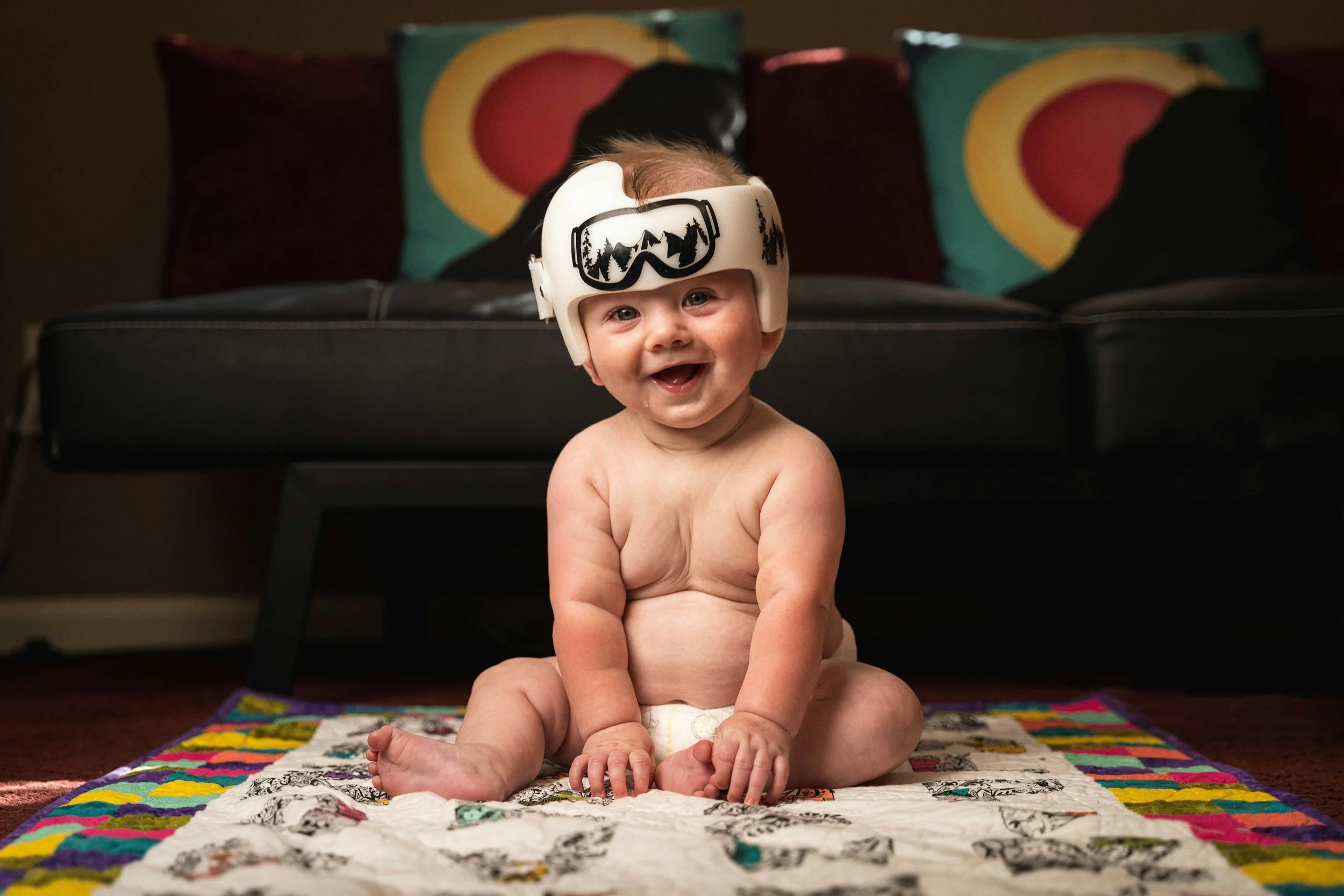Plagiocephaly: Flat Head Syndrome Explained (and When to Seek Help)