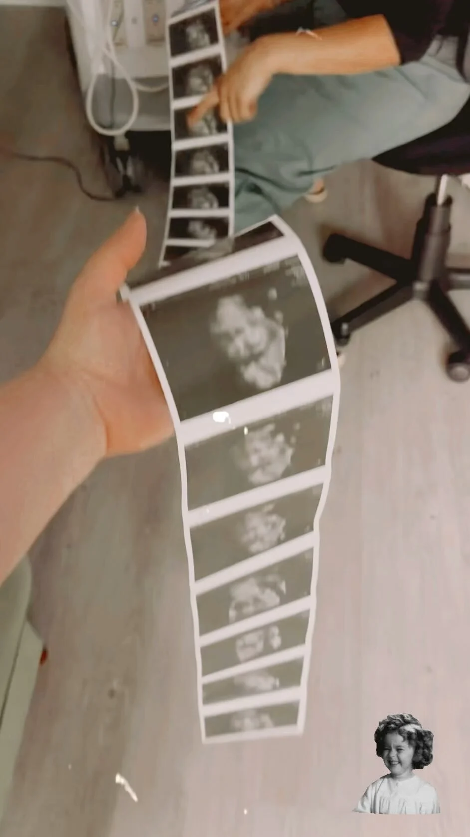 Ivue Baby We Provide 3D 4D 5D Ultrasound Gender Determination Test ivue-baby-we-provide-3d-4d-5d-ultrasound-gender-determination-test