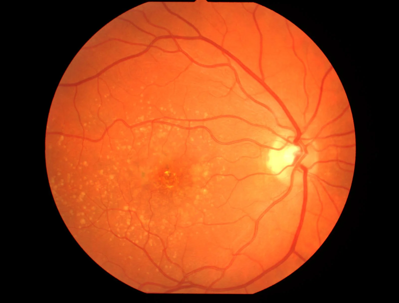 About — Retina Associates of Southern Utah