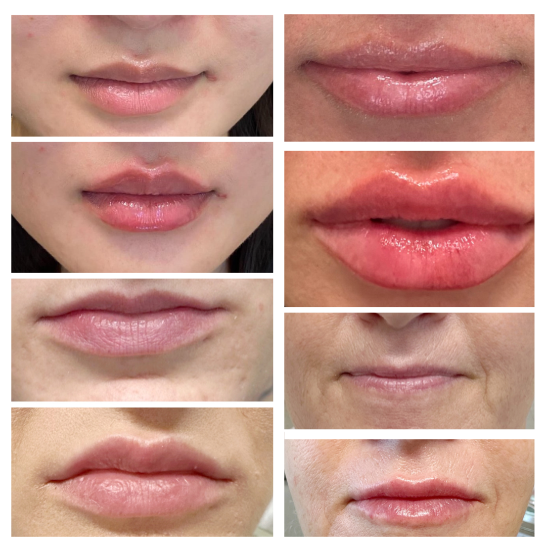 lips.png