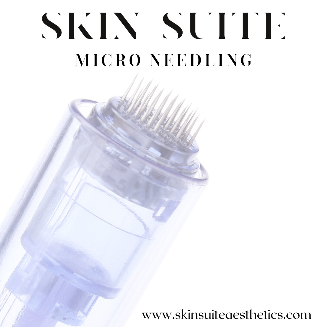 Hello Micro-needling...​​​​​​​​​
Here is some information on our MOST popular skin treatment at SS - let's go 👉

Micro needling is a cosmetic procedure that is used to encourage collagen production using small, sterilized needles. It may help smooth