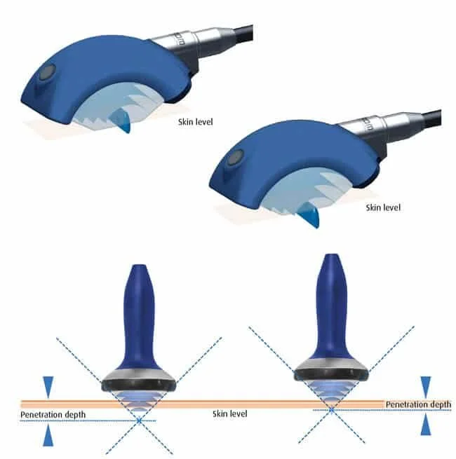 TriForce Wave Therapy