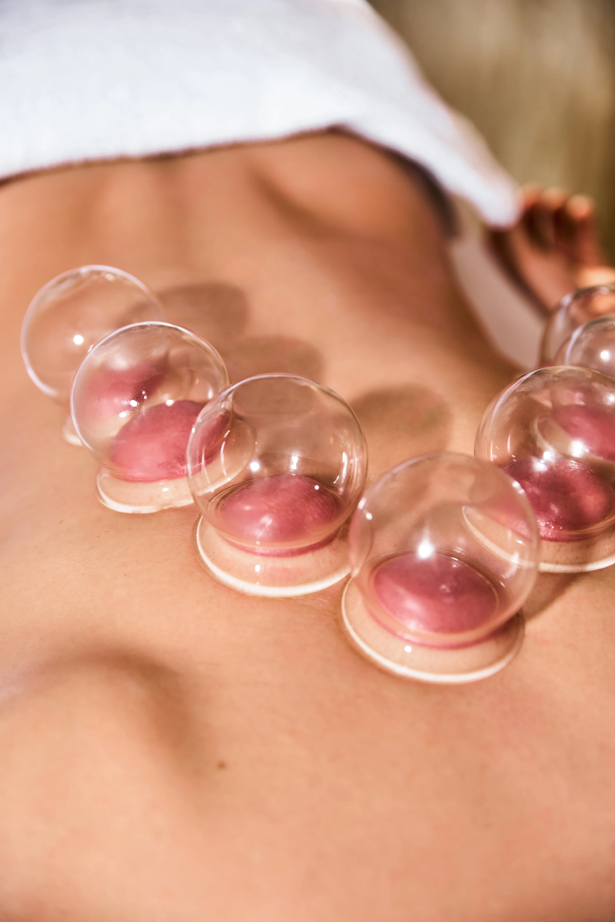 2025.03.12 Salzburgerhof Zell am See Schröpfen2826 Kopie.jpg