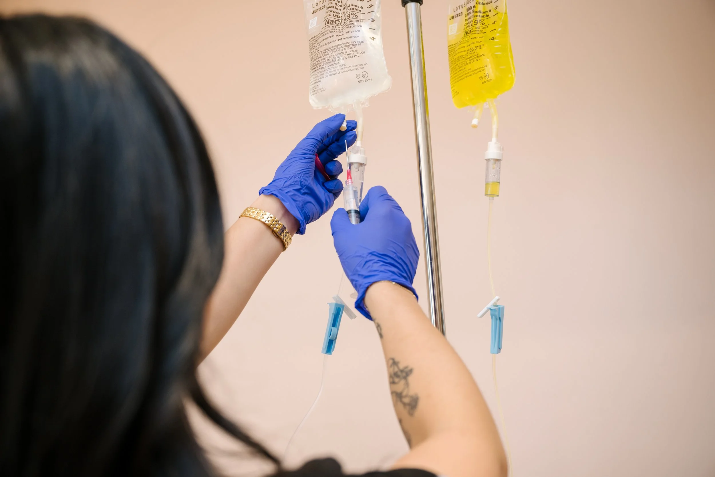 IV iron infusion delivering iron directly into bloodstream during pregnancy treatment