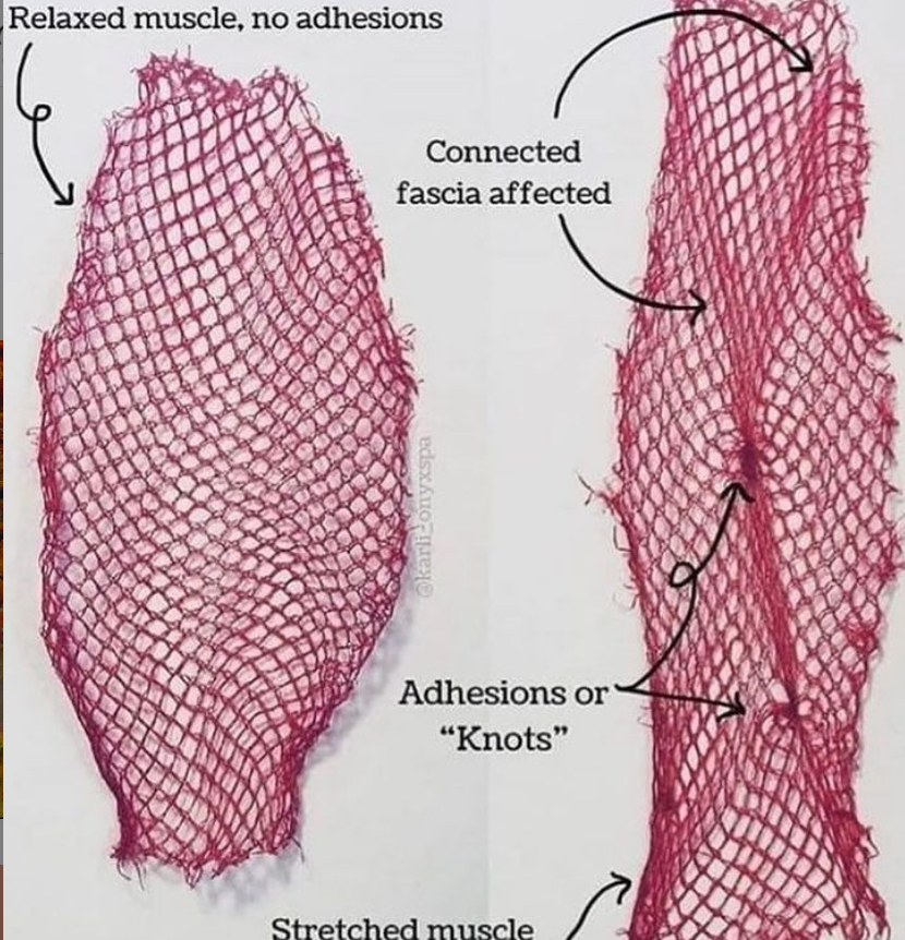 Fascial Counterstrain