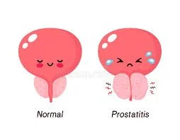 The Myths and Truths About Prostatitis and How Pelvic Floor Therapy Can Help