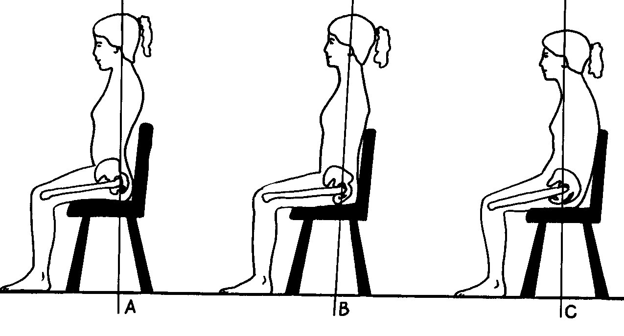Why am I Having Pain with Sitting?