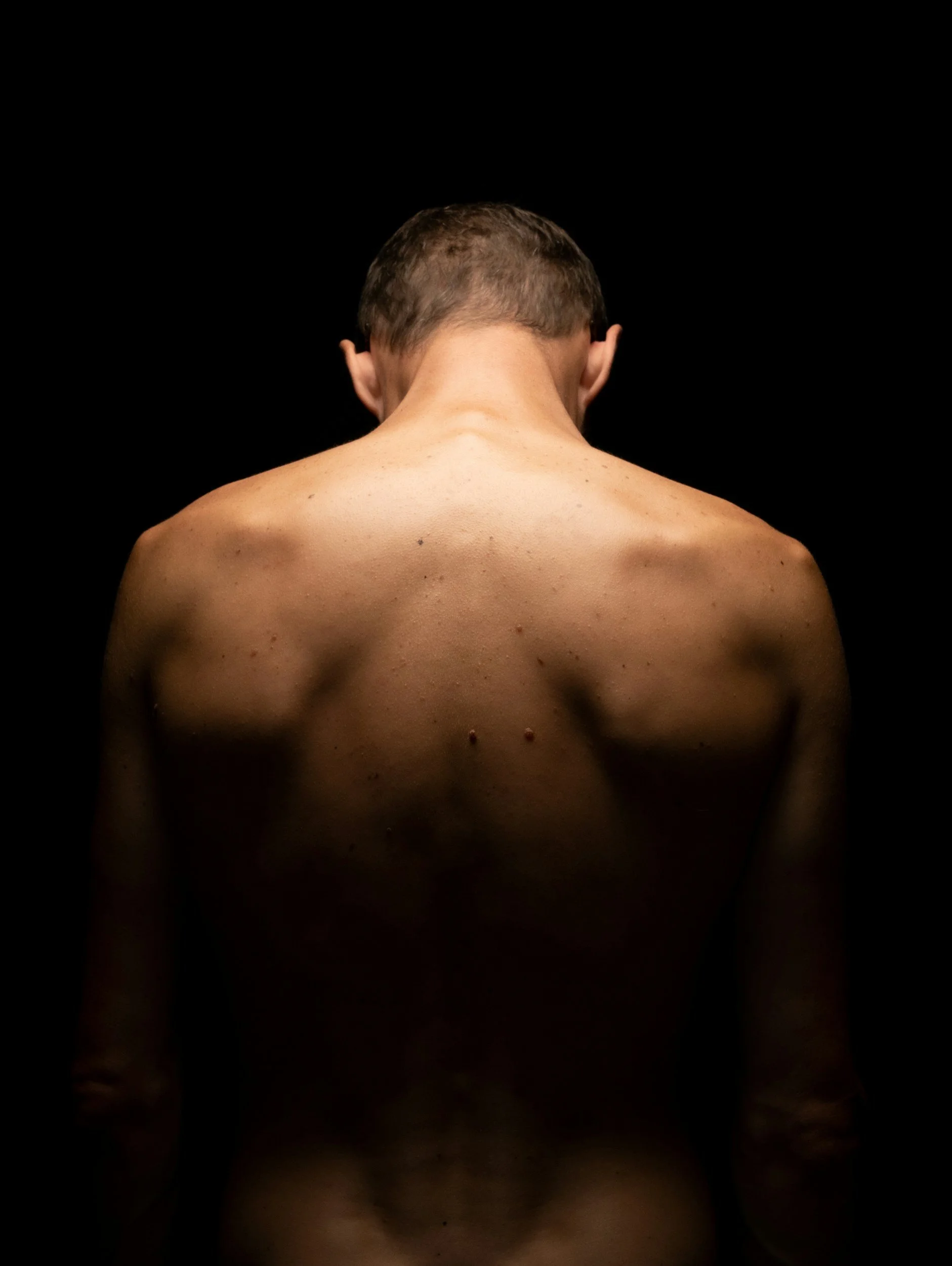 Does My Tight Back Contribute to Erectile Dysfunction?