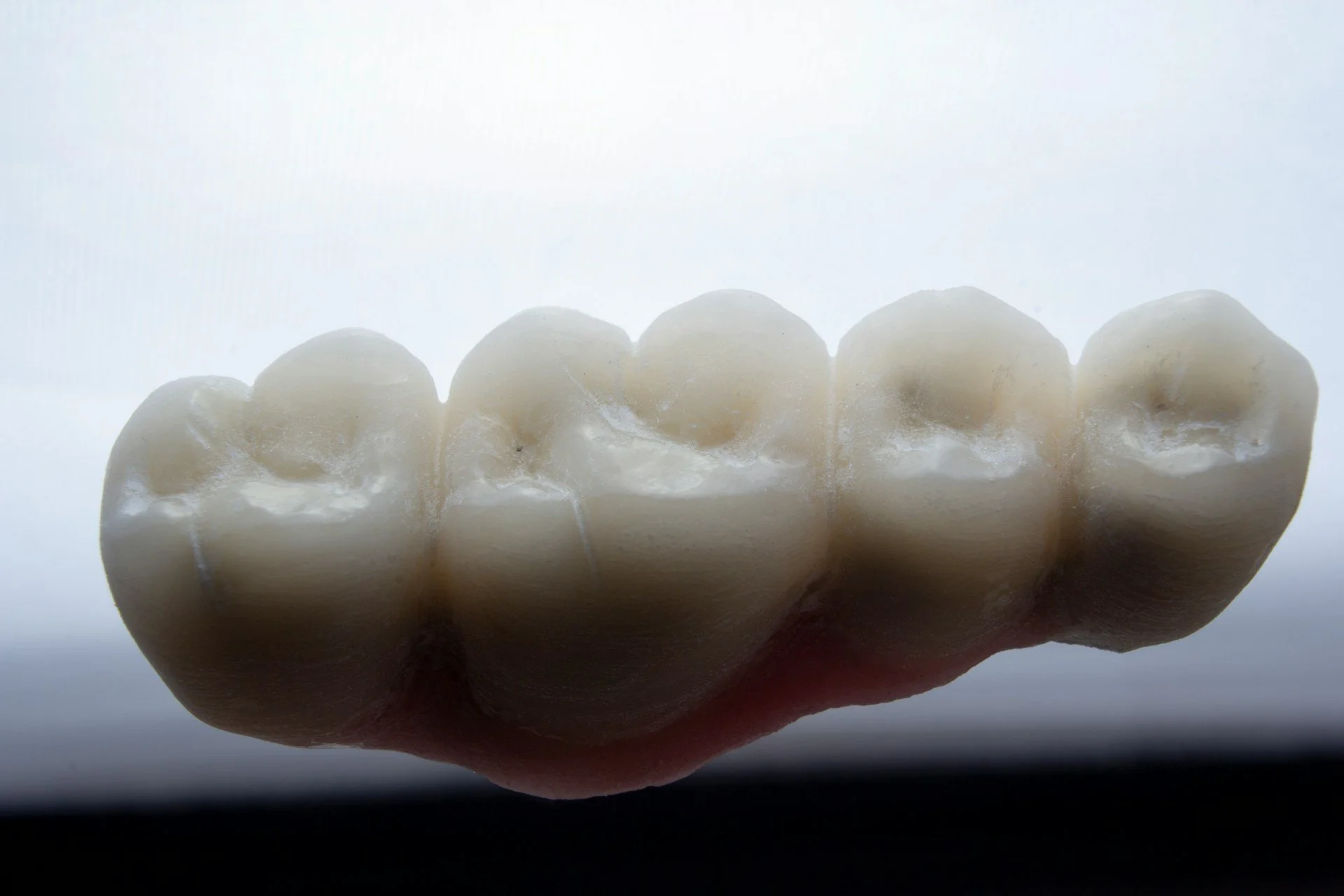 Is Laser Dentistry Pain-Free? What Patients Need to Know