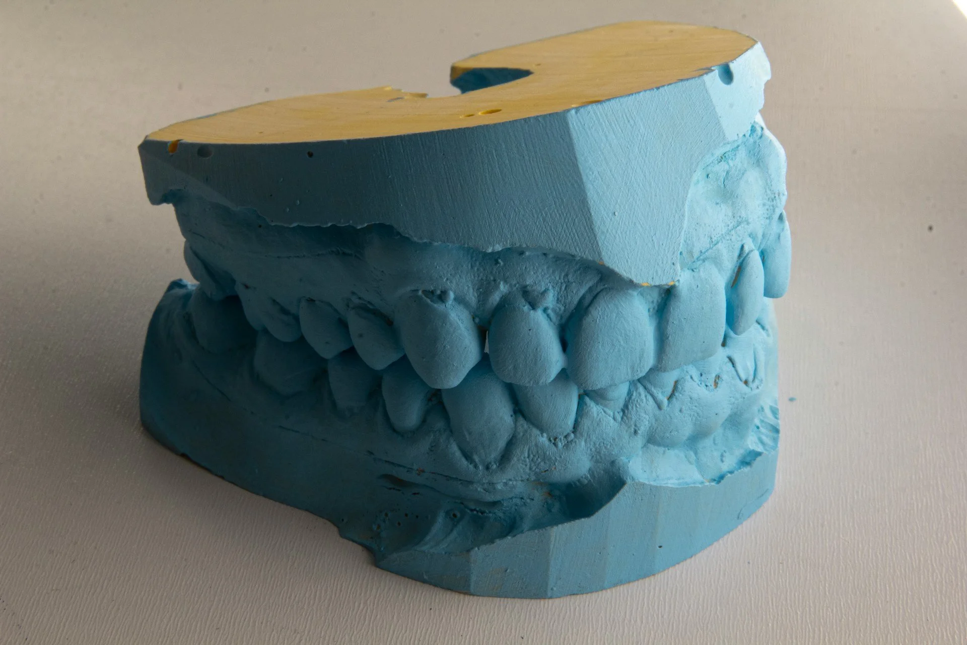 Healing Times After Laser Dental Procedures