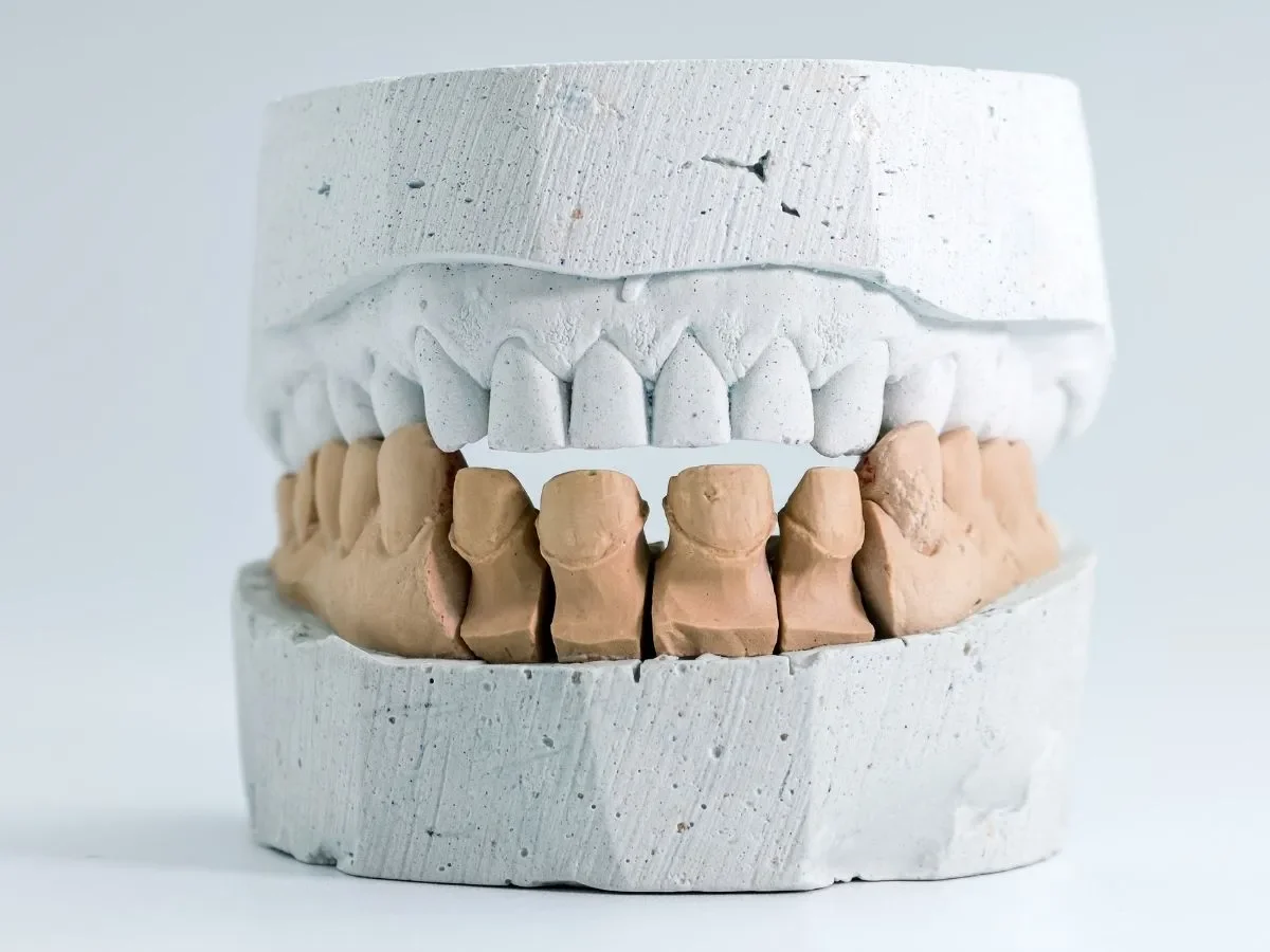 Common Problems Fixed by Same-Day Dental Crowns