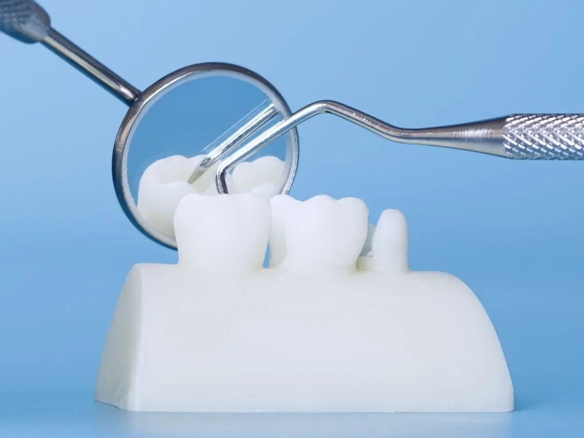 The Step-by-Step Process of Getting a Same-Day Crown