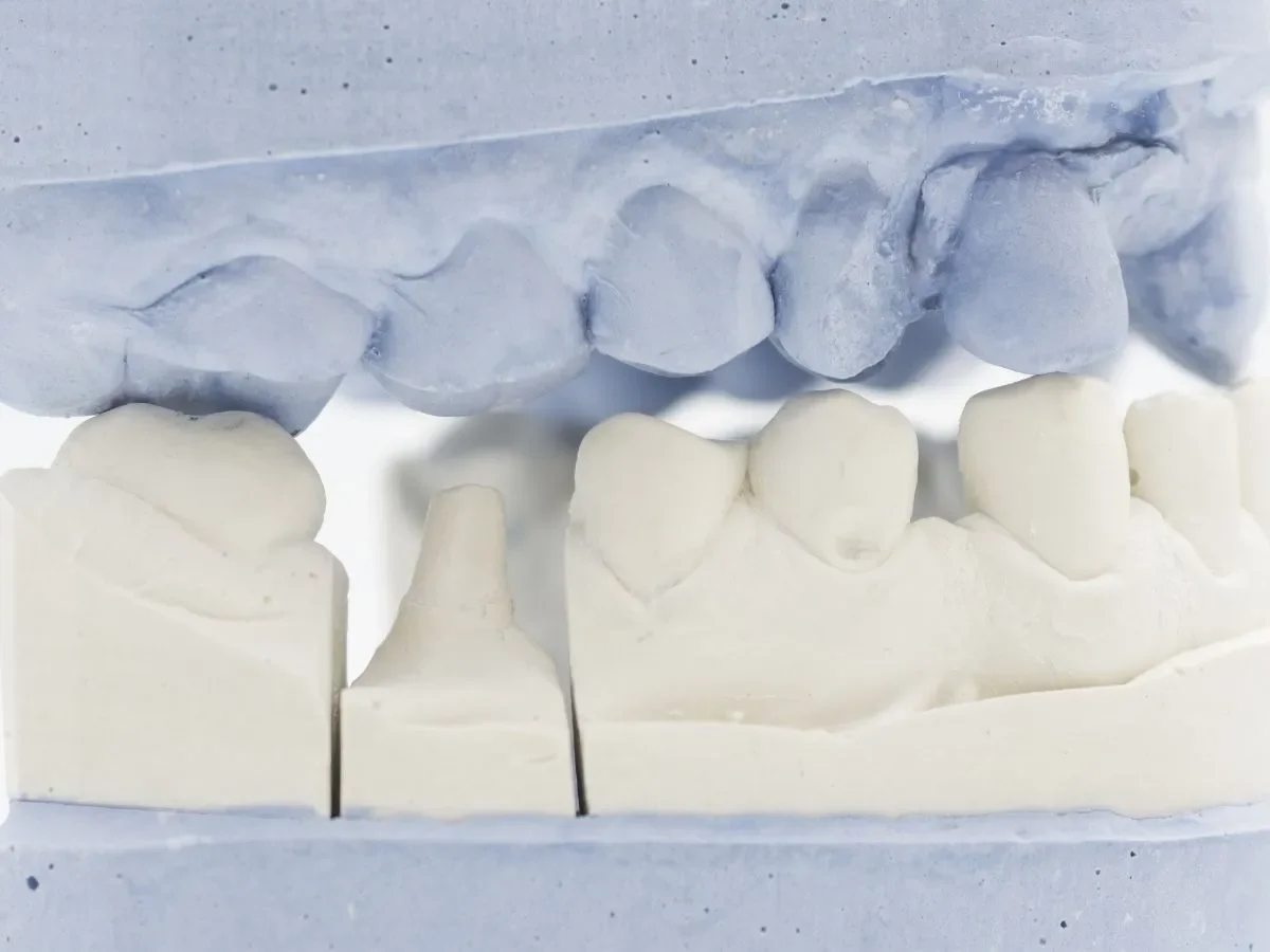 Why Langley Patients Are Choosing Laser Dentistry