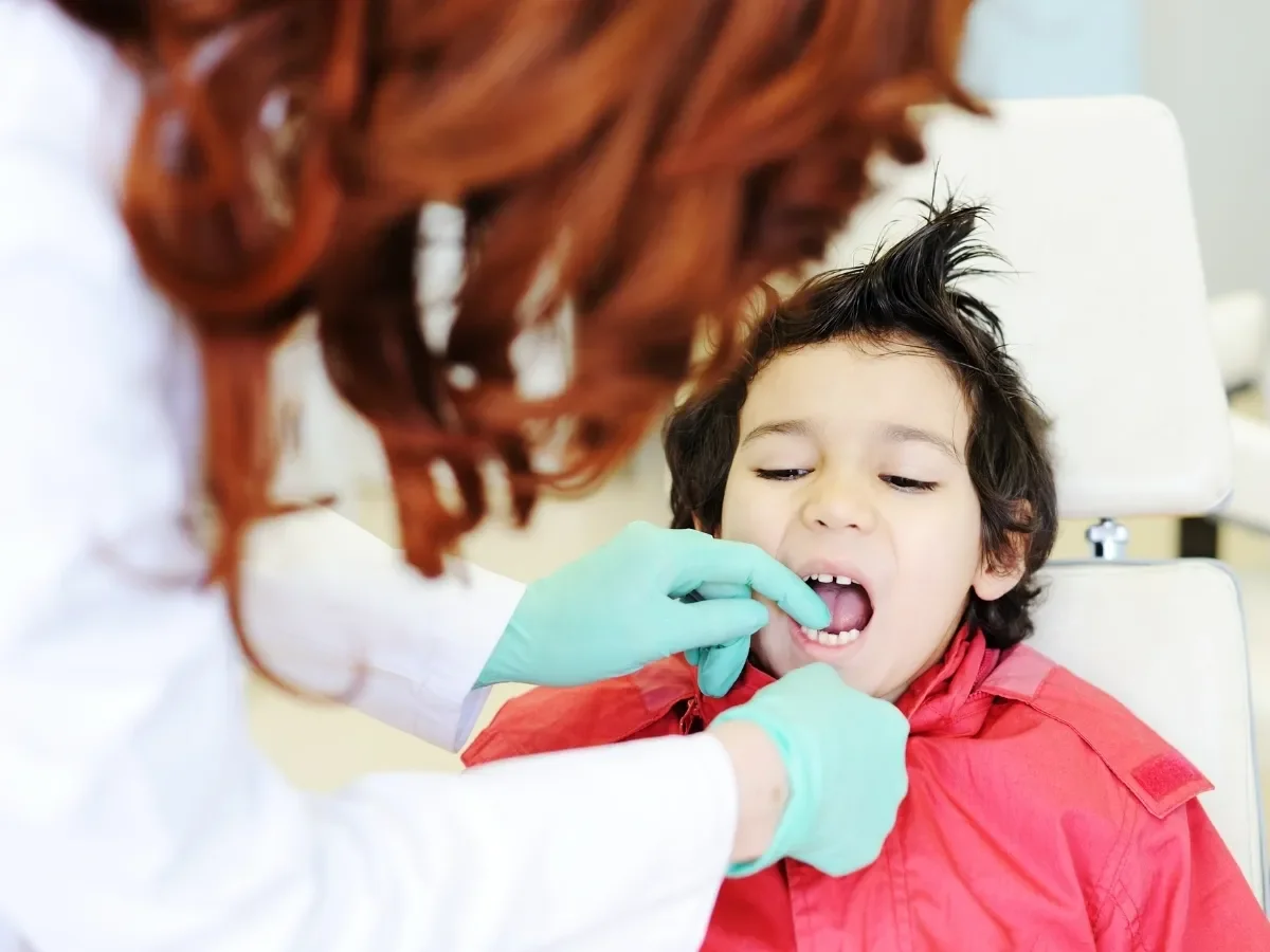 Sealants for Kids: Are They Worth It?