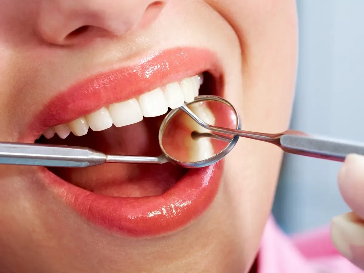Why You Shouldn’t Ignore Dental Infections