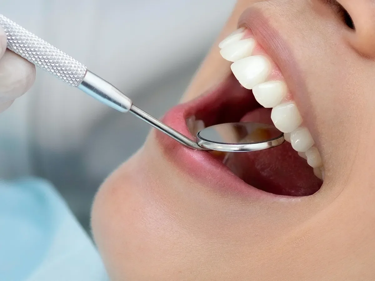 The Dental Implant Process Step-by-Step