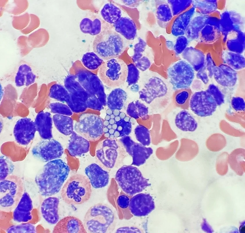 Hematology — Heme Onc Notes