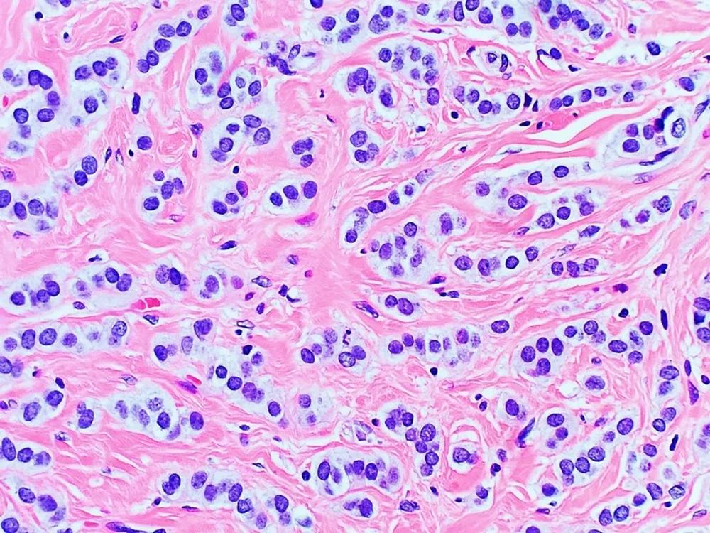 Oncology — Heme Onc Notes