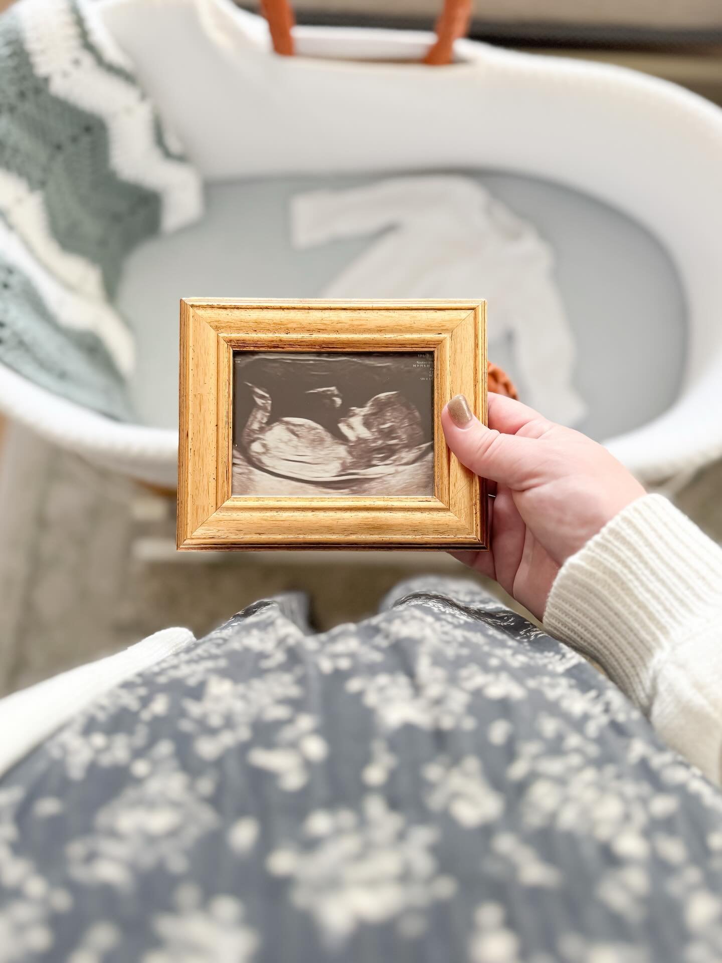 We can&rsquo;t wait to meet you on Monday, sweet boy 🕊️