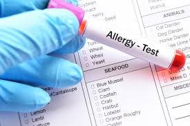 Alex Allergy Test