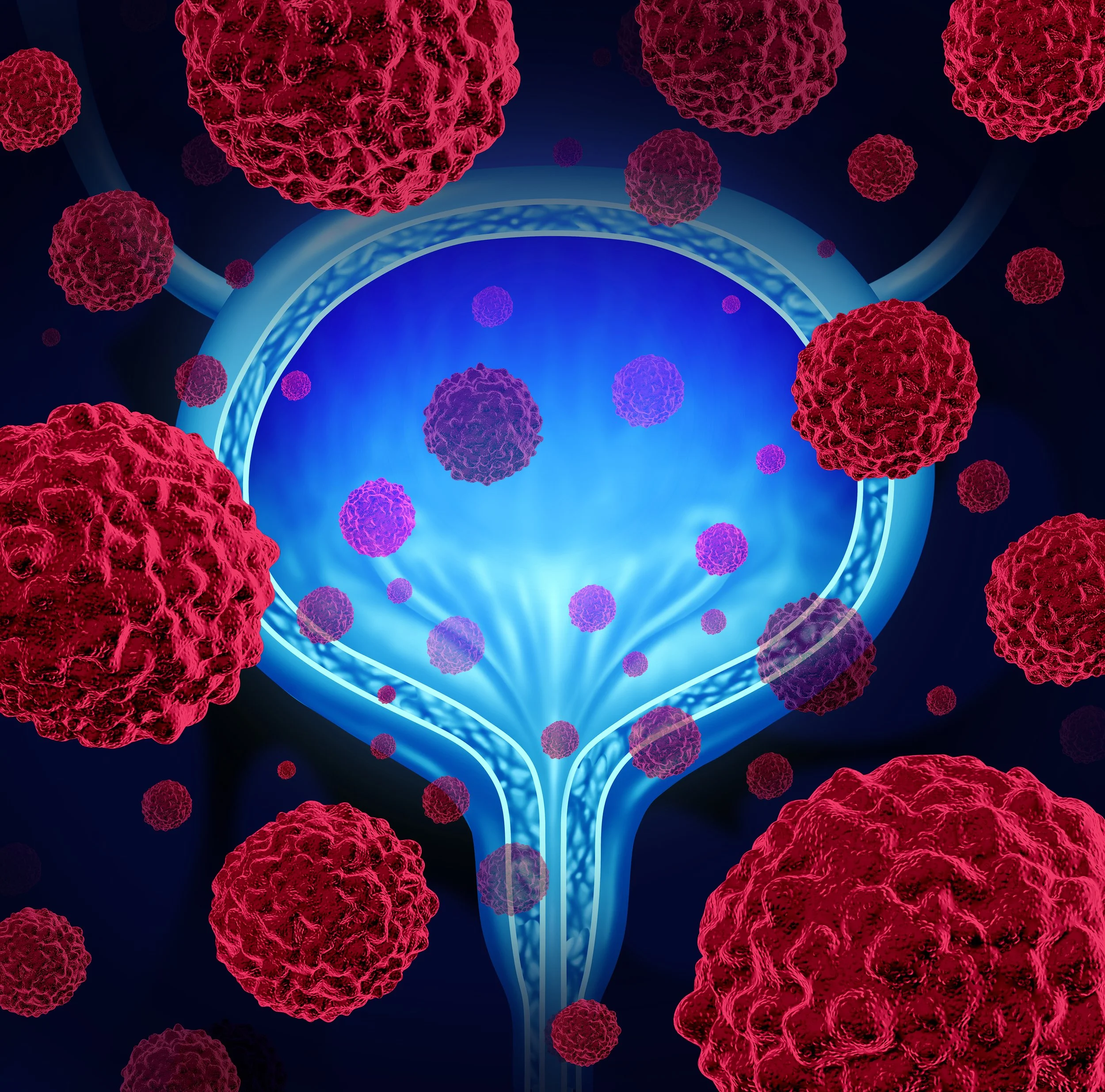 Prostate and Bladder Cancer US Policy Strategy