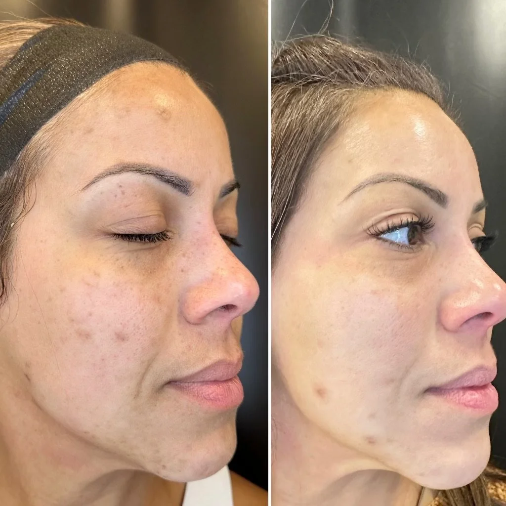 AionB+A380019F8-48B0-4224-8E4F-D121F5AFA664 (1).jpeg